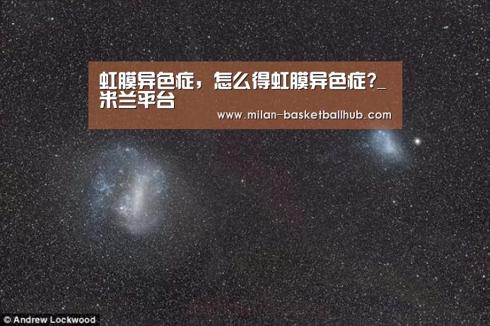 虹膜异色症,怎么得虹膜异色症?_米兰平台(图1) 米兰平台